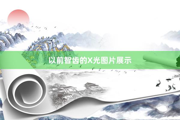 以前智齿的X光图片展示
